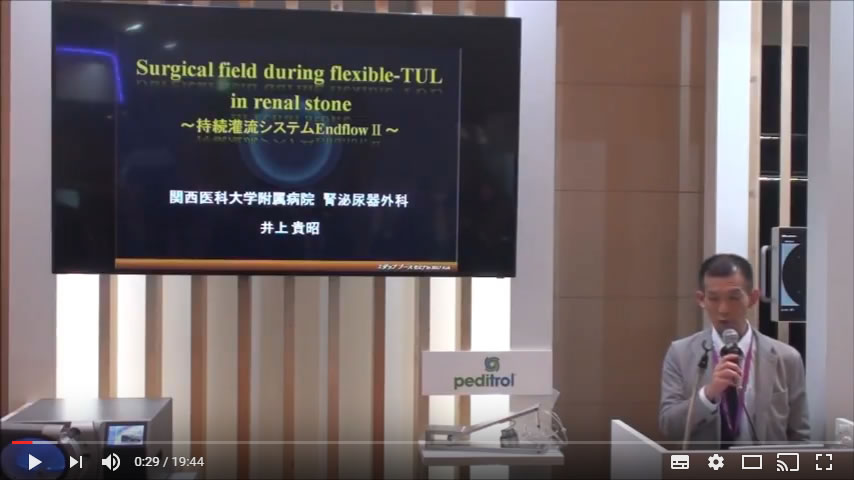 Surgical field during flexible TUL in renal stone 持続灌流システムEndoflow Ⅱ