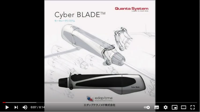Cyber BLADE / モーセレーション